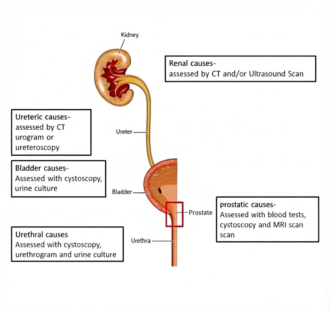 How blood in the urine is investigated — the tests used at The Andrology Centre